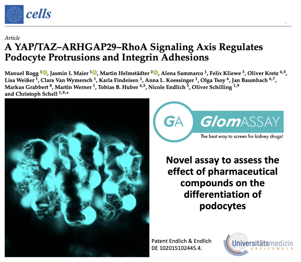 A great cooperation between Freiburg-Hamburg-Greifswald has now led to an exciting and important paper published in 'Cells' (IF:6,0). We @UMGreifswald included our GlomAssay (Kindt et al. Br J Pharmacol. 2017). Many thanks to all cooperation partners and enjoy the summer time!