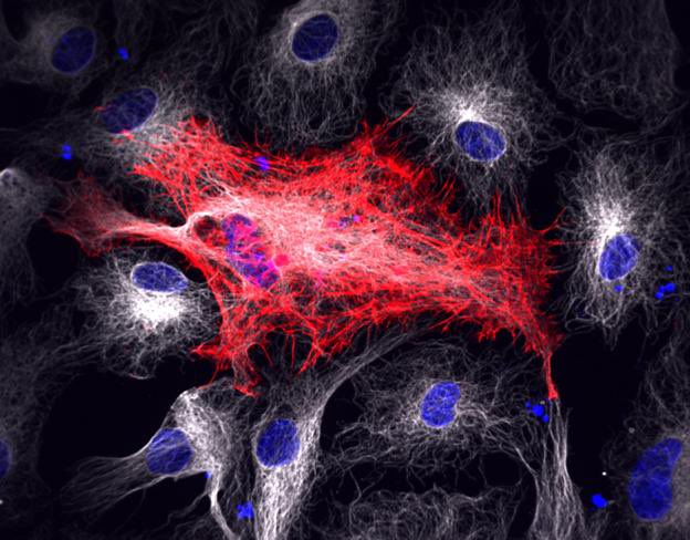 The Serio Lab (@theseriouslab) on Twitter photo We don’t want to FORCE you, but our very own <a href="/LudovicaGuetta/">Ludovica Guetta</a> is presenting her poster on how mechanical forces control astrocyte reactivity, shape and function ⚡️⚙️⭐️ and you really don’t want to miss it! Her poster is TODAY, T04-001B at #euroglia #glia2023 see you there! We don’t want to FORCE you, but our very own <a href="/LudovicaGuetta/">Ludovica Guetta</a> is presenting her poster on how mechanical forces control astrocyte reactivity, shape and function ⚡️⚙️⭐️ and you really don’t want to miss it! Her poster is TODAY, T04-001B at #euroglia #glia2023 see you there!