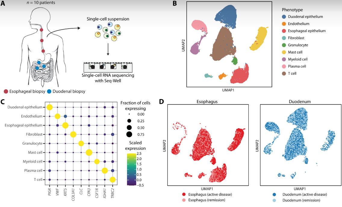 SciImmunology's tweet photo. Two 2021 studies described T cell drivers of hard-to-treat #allergic diseases—food allergen-triggered eosinophilic #esophagitis and chronic #rhinosinusitis with nasal polyps. #WeekendReads

From @kochinstitute: https://t.co/hVtRb8iawy
From @MTC_KI: https://t.co/5hwS490HbB https://t.co/wByZsWZzCq