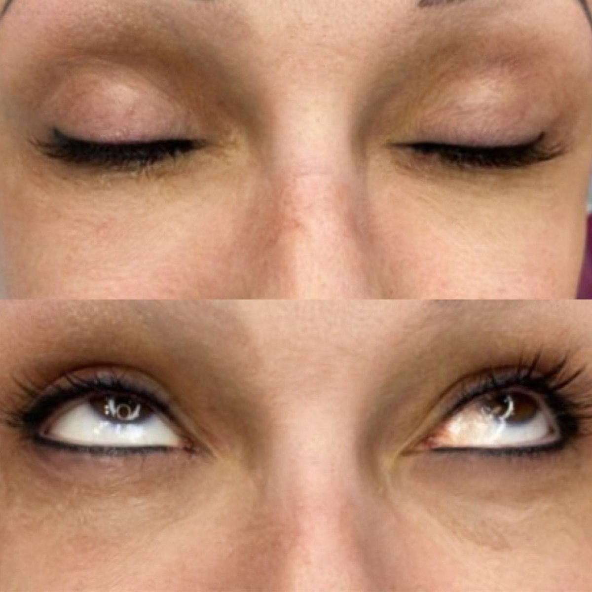 ATXPMU's tweet photo. #permanentmakeup #booknow #lashlineenhancement #eyelinertattoo #atxpmu https://t.co/0F2lqLDOmY