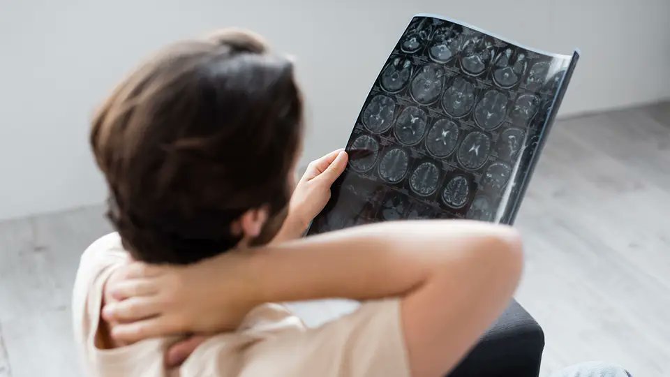 MedliberNn's tweet image. 🧠Man Presents With Episodic, One-Sided Facial #Paralysis
A man in his 30s had been experiencing episodes of partial paralysis...
Visit: bit.ly/3rkjvtA
#medLiber #medicallibrary #medLiberpublishinggroup #Neurology