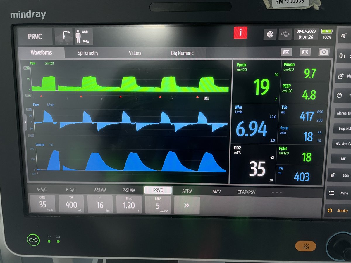 صار عندي بيشنت له فترة intubated وأمس لما جيت أشيك على ETT، كان طالع شوي وعملت له suction وعدلت التيوب بس في صوت gurgling وكأنه في leak 👀 مع ان cuff inflated 

بس زي ما تشوفوا الفنتلتير مو عاطيني أي علامة على leak

What could be going on? 🤓
ليش الفنتلتير مو قاعد يعطيني ليك؟ 👀