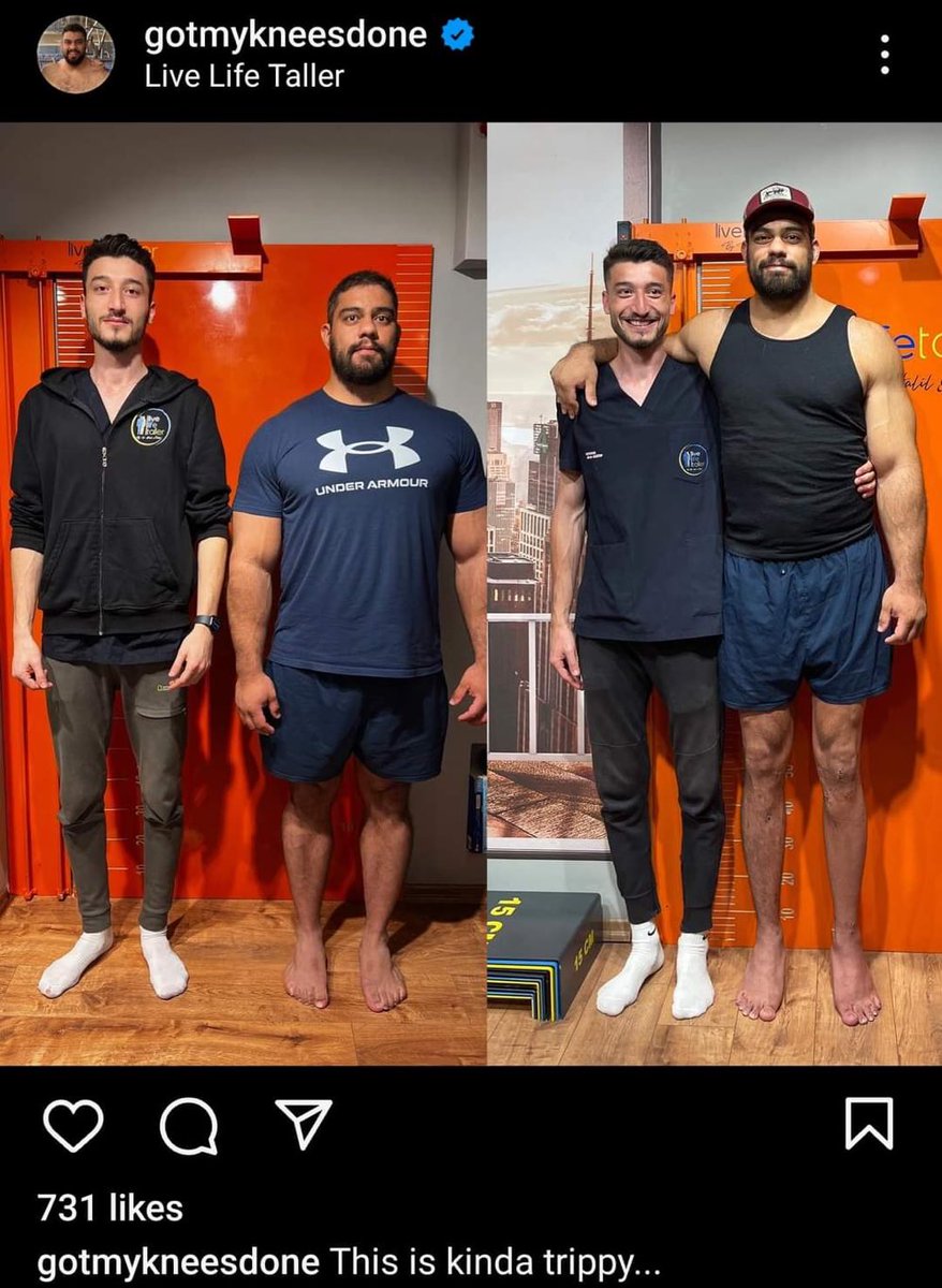 Itspedrito's tweet photo. gente a cirurgia pra aumentar a altura eh real e assustadora kkkkk https://t.co/vKNqsLrLyZ
