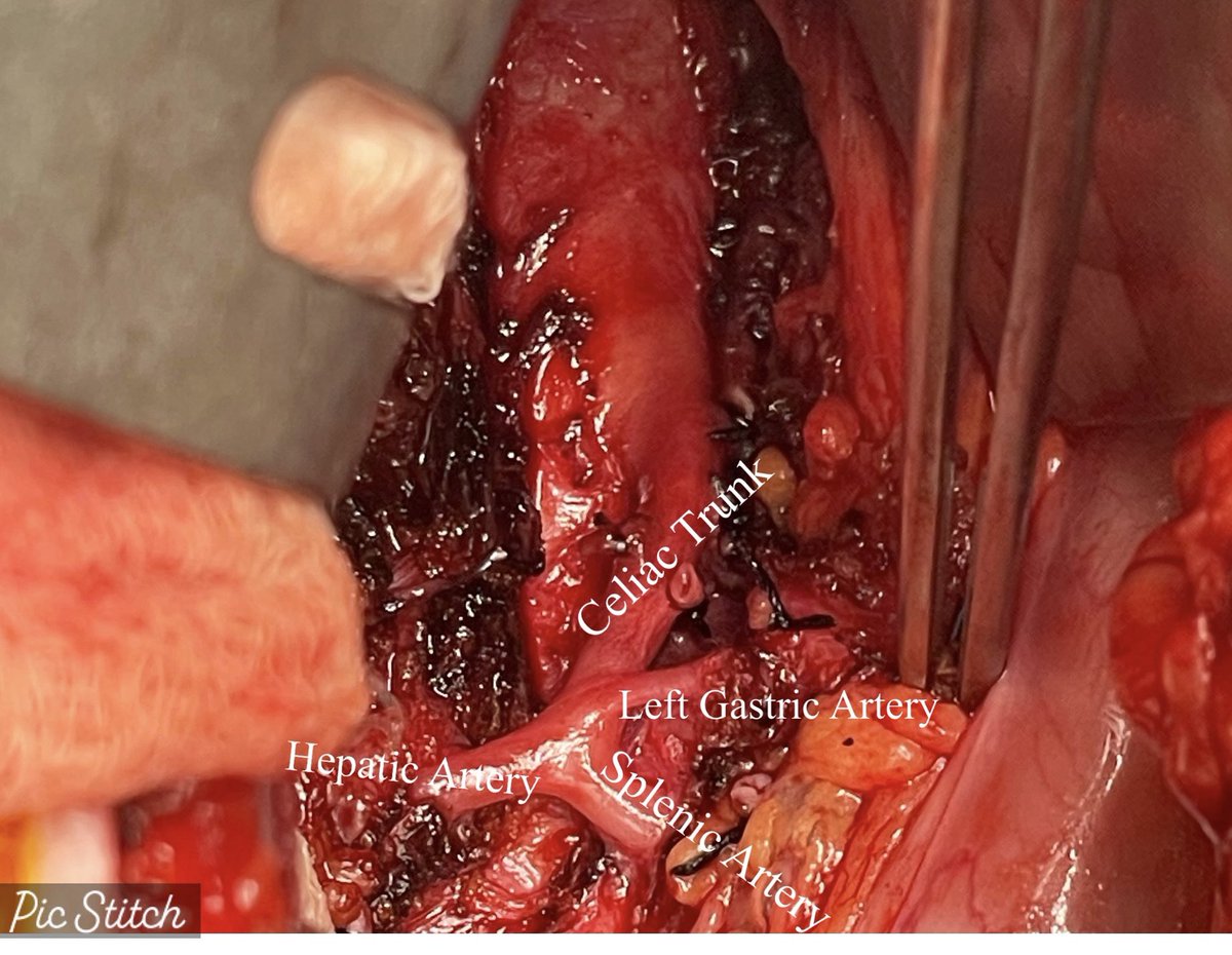 NavYash Gupta, MD, RPVI, FACS tweet media