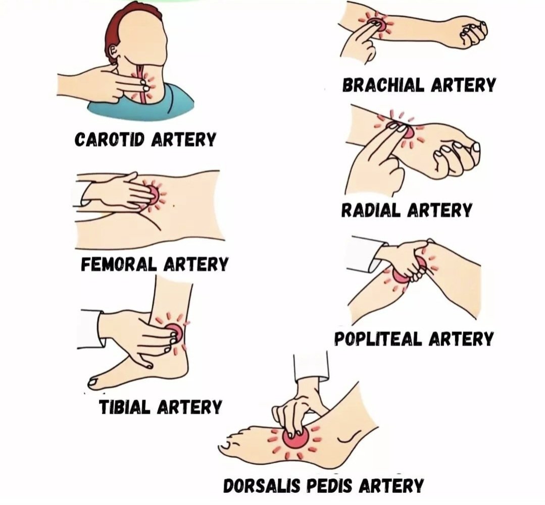 🌟 The 8 anatomical points for assessing peripheral arterial pulse in our video! 

  🎥📺👇
youtu.be/-YTKP9sA-9g