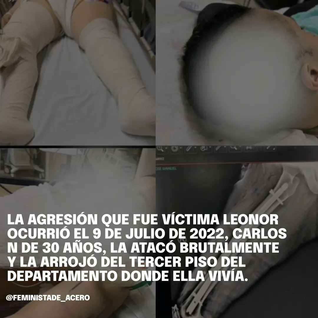 FeministaDeAcer's tweet photo. #JusticiaParaLeonor

Leonor fue víctima de un intento de feminicidio por parte de su pareja sentimental Carlos Gerardo “N”, quien la lanzó de un tercer piso. Actualmente, Leonor permanece en estado vegetativo y Carlos “N”, se encuentra en libertad.
@FiscaliaCDMX https://t.co/AG3MgSraGL