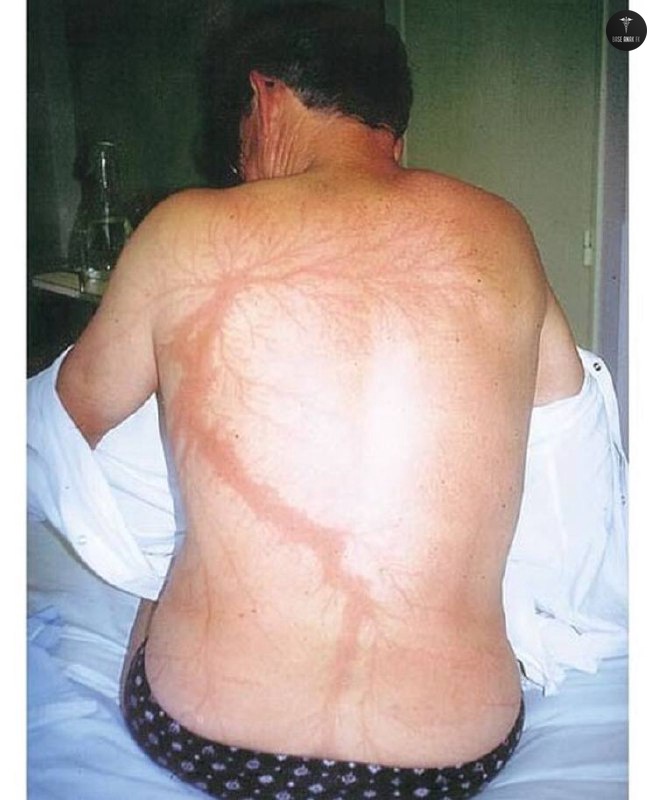 BaseAnakFK's tweet image. dok Mari saling sharing ilmu
Coba tebak apa penyebab tubuh manusia menjadi seperti gmbr ini, jangan oot ya repnya