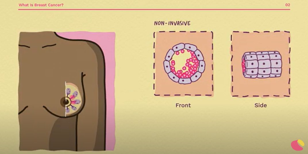 Breast Cancer Now tweet media