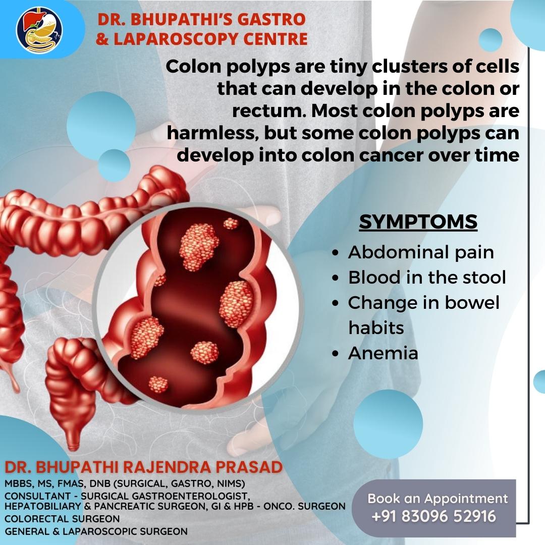 BhupathiRajend5's tweet image. #Colonpolyps found in the #early stages can usually be removed safely and completely. 

#Coloncancer can be prevented by regular #screening. 

Consult with our #Gastroenterologist for proper treatment.

😎Follow us for Advanced Care.

☎️Call: +91 8309652916