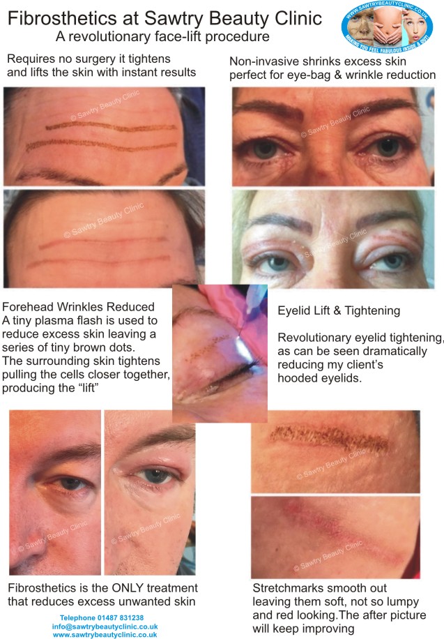 Sawtry Beauty Clinic tweet media