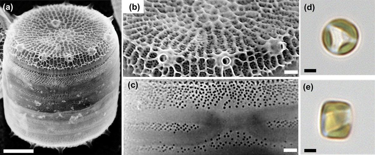 Thomas Mock (@th_mock) on Twitter photo The model #diatom Thalassiosira pseudonana (Cyclotella nana)
New perspective piece just out <a href="/JPhycology/">Journal of Phycology</a>
by <a href="/NicolePoulsen6/">Nicole Poulsen</a> & <a href="/kroeger_nils/">Nils Kröger</a>
onlinelibrary.wiley.com/doi/full/10.11… The model #diatom Thalassiosira pseudonana (Cyclotella nana)
New perspective piece just out <a href="/JPhycology/">Journal of Phycology</a>
by <a href="/NicolePoulsen6/">Nicole Poulsen</a> & <a href="/kroeger_nils/">Nils Kröger</a>
onlinelibrary.wiley.com/doi/full/10.11…