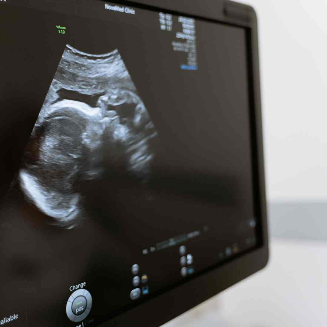 Pruebas de infertilidad: ¿Sabes las más frecuentes? 
Cuando una pareja consulta a un especialista hay una serie de #pruebasdefertilidad que pueden utilizarse para establecer un diagnóstico. De esta manera, podemos valorar cada caso

vidafertility.com/pruebas-de-inf…