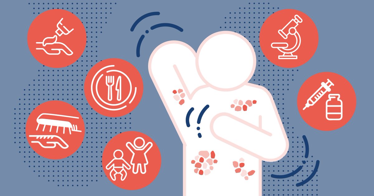 Be Part of Research (@nihrtakepart) on Twitter photo For some people psoriasis is just a minor irritation, but for others it can have a significant impact on their quality of life.
We take a look at <a href="/NIHRresearch/">National Institute for Health and Care Research</a> aimed at improving the diagnosis and treatment of the skin condition.
bepartofresearch.nihr.ac.uk/articles/psori… For some people psoriasis is just a minor irritation, but for others it can have a significant impact on their quality of life.
We take a look at <a href="/NIHRresearch/">National Institute for Health and Care Research</a> aimed at improving the diagnosis and treatment of the skin condition.
bepartofresearch.nihr.ac.uk/articles/psori…