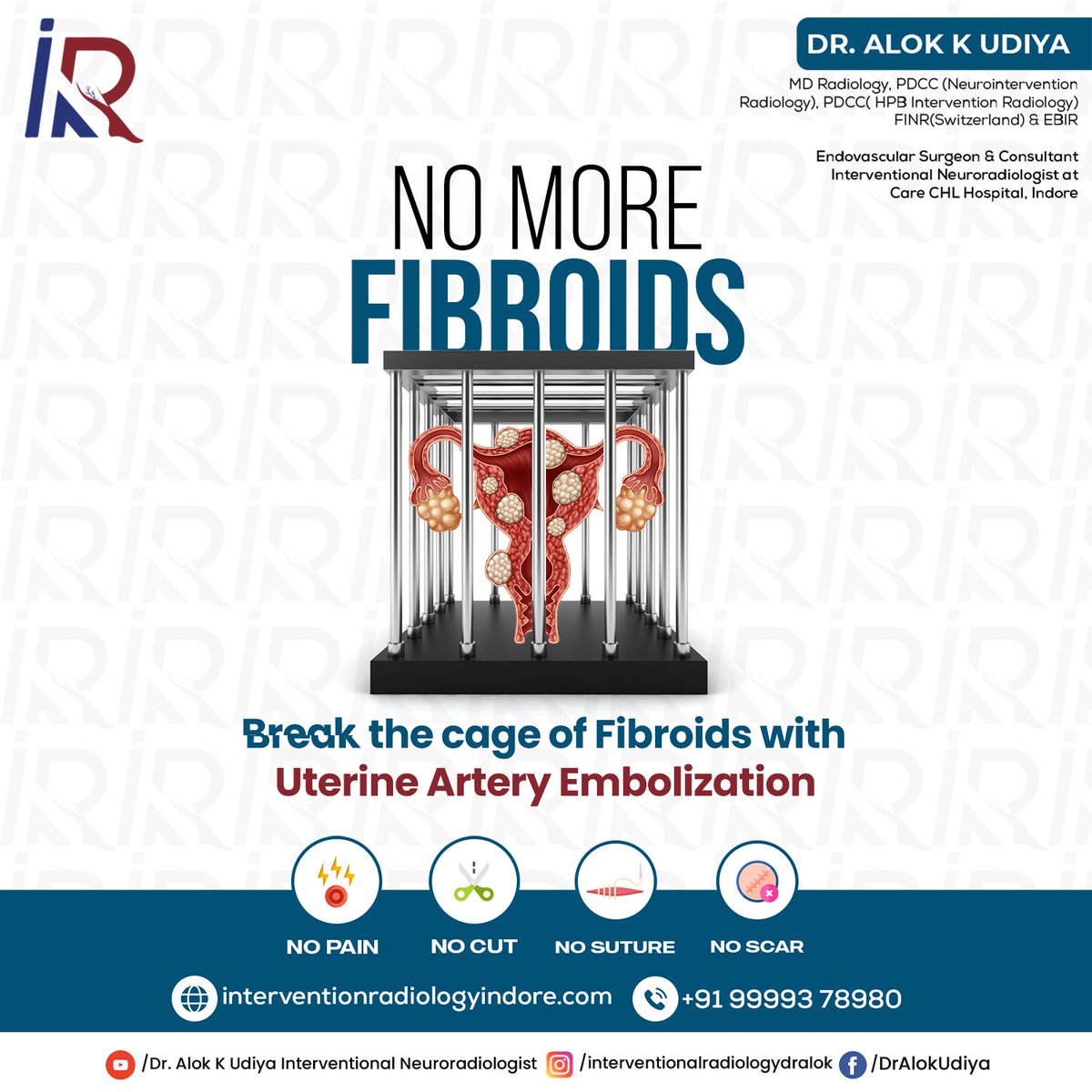 Unlock the door to a fibroid-free future!✨
Book your appointment today with
📲 +91 99993 78980
or Visit
Care CHL Hospital, LIG Square, Rss Nagar, Indore
Website- interventionradiologyindore.com
#fibroidawarenessmonth #dralokkudiya #dralok #uterinefibroids #saveuterus #myomas #leiomyomas