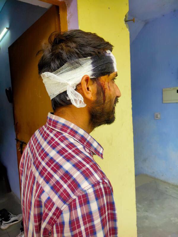 Last night at chc ghat, chamoli at 2.30 pm, 6 people along with a drunken patient attacked Dr. Rohit Chauhan, no one has been arrested by the police till the day.

Requesting <a href="/chamolipolice/">Chamoli Police Uttarakhand</a> <a href="/Uttrakhand_News/">Uttrakhand News</a> <a href="/ANINewsUP/">ANI UP/Uttarakhand</a> <a href="/pushkardhami/">Pushkar Singh Dhami</a> to intervene in this matter .