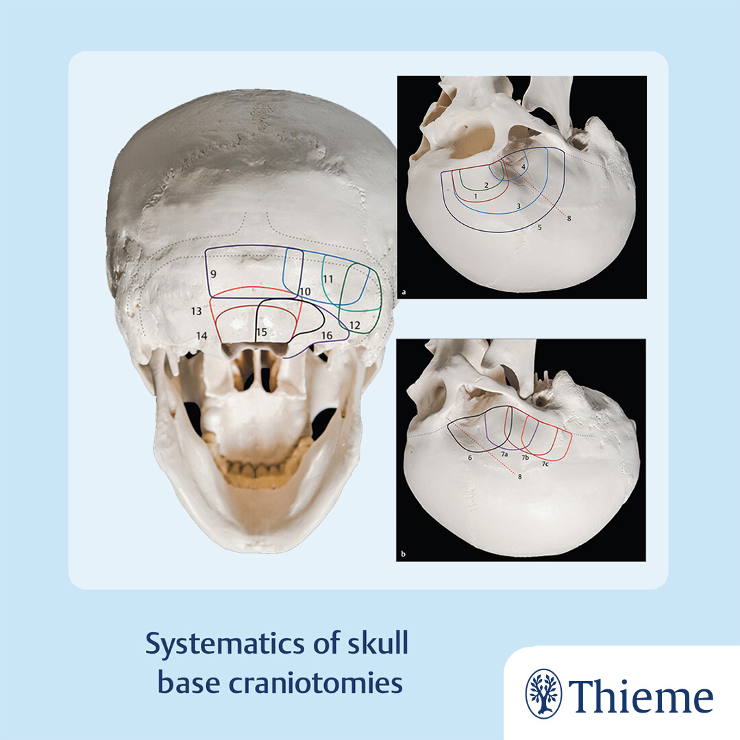 Thieme International on Twitter: "New free content on MedOne #