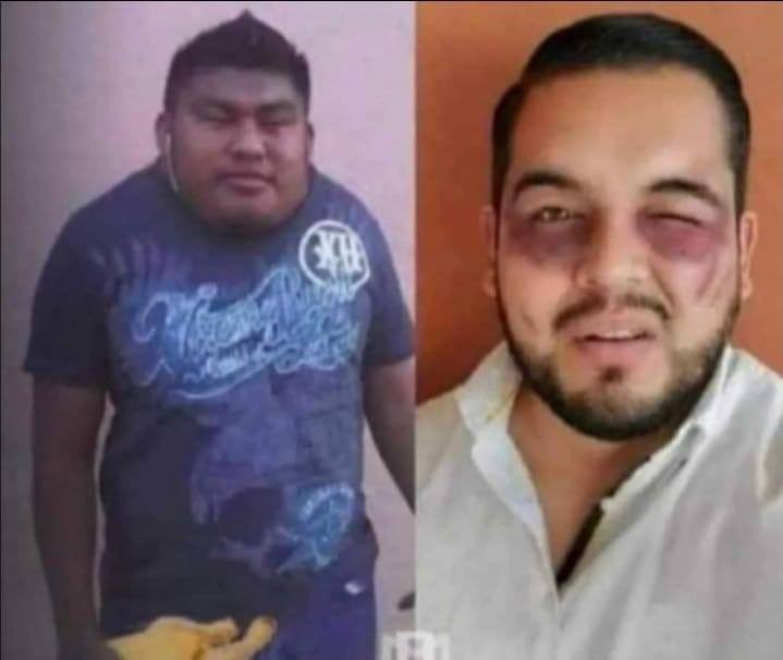 El vendedor de pollo / Yo, después de preguntarle si tenía pescuezo.