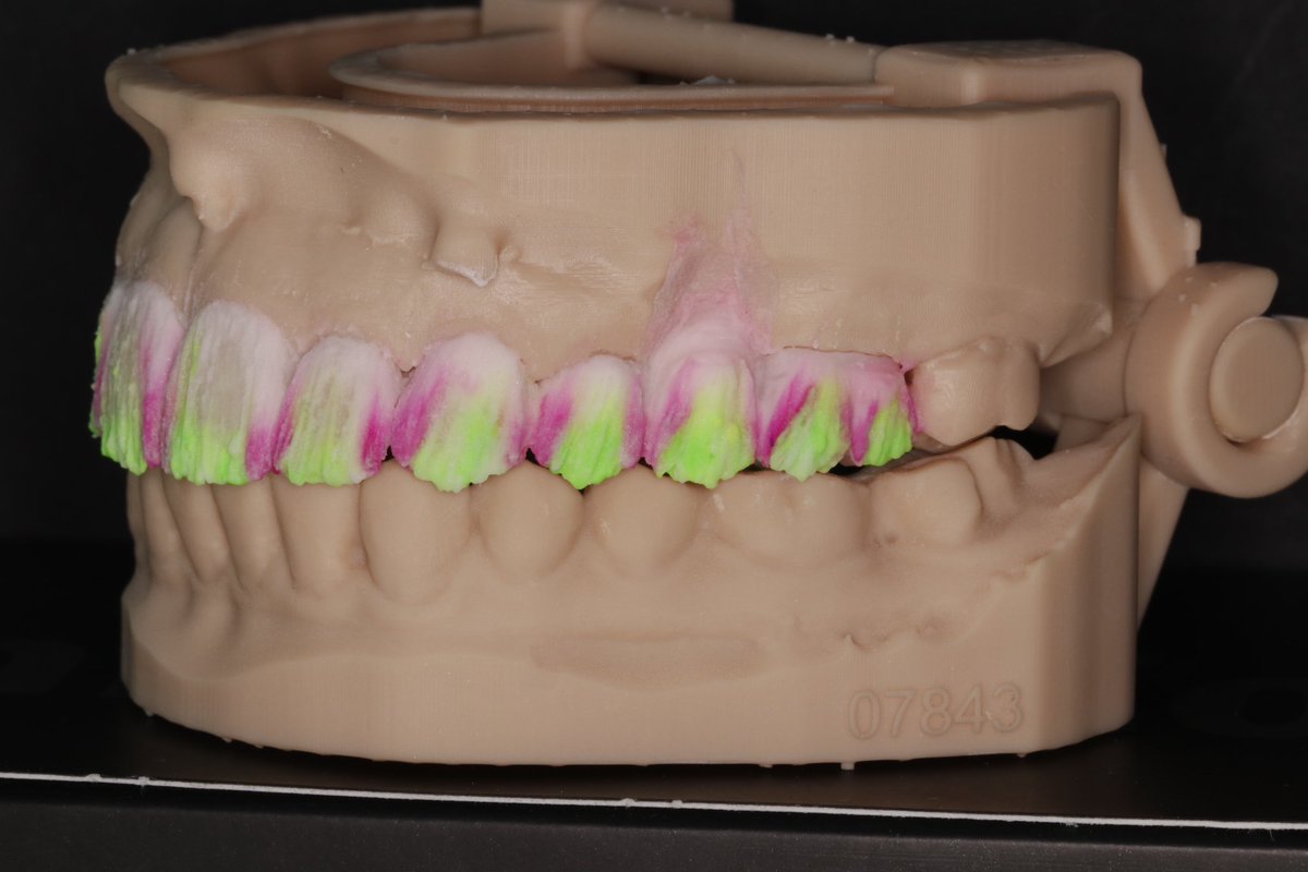 Work in progress 🦷🛠️👩‍🔬