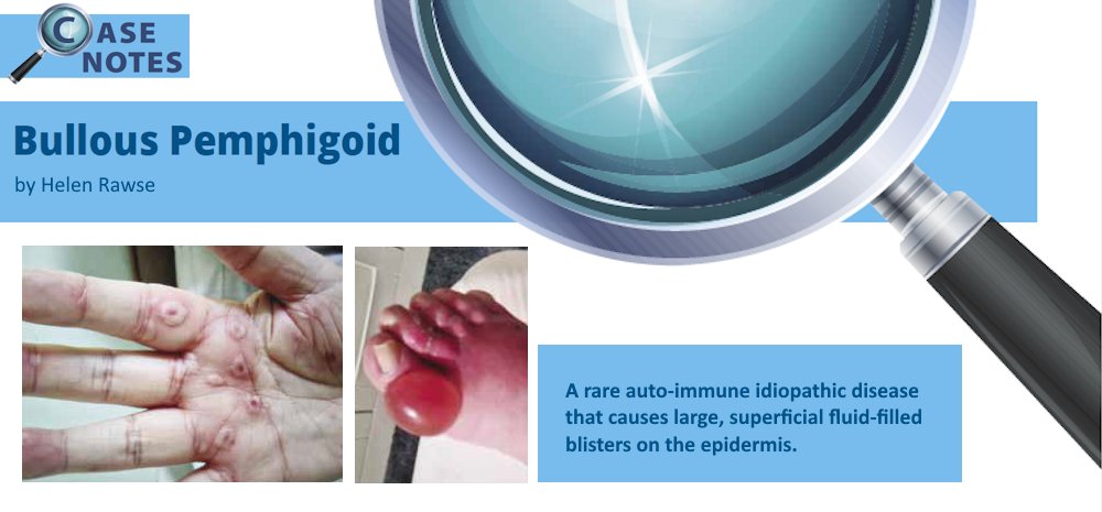 IOP_Podiatry's tweet image. An incredible 'Case Notes' article written by Helen Rawse on Bullous Pemphigoid in Q3 Podiatry Review iocp.org.uk/case-notes-bul…
#foothealthexperts #podiatry #chiropody #foothealth #FHP #footcare