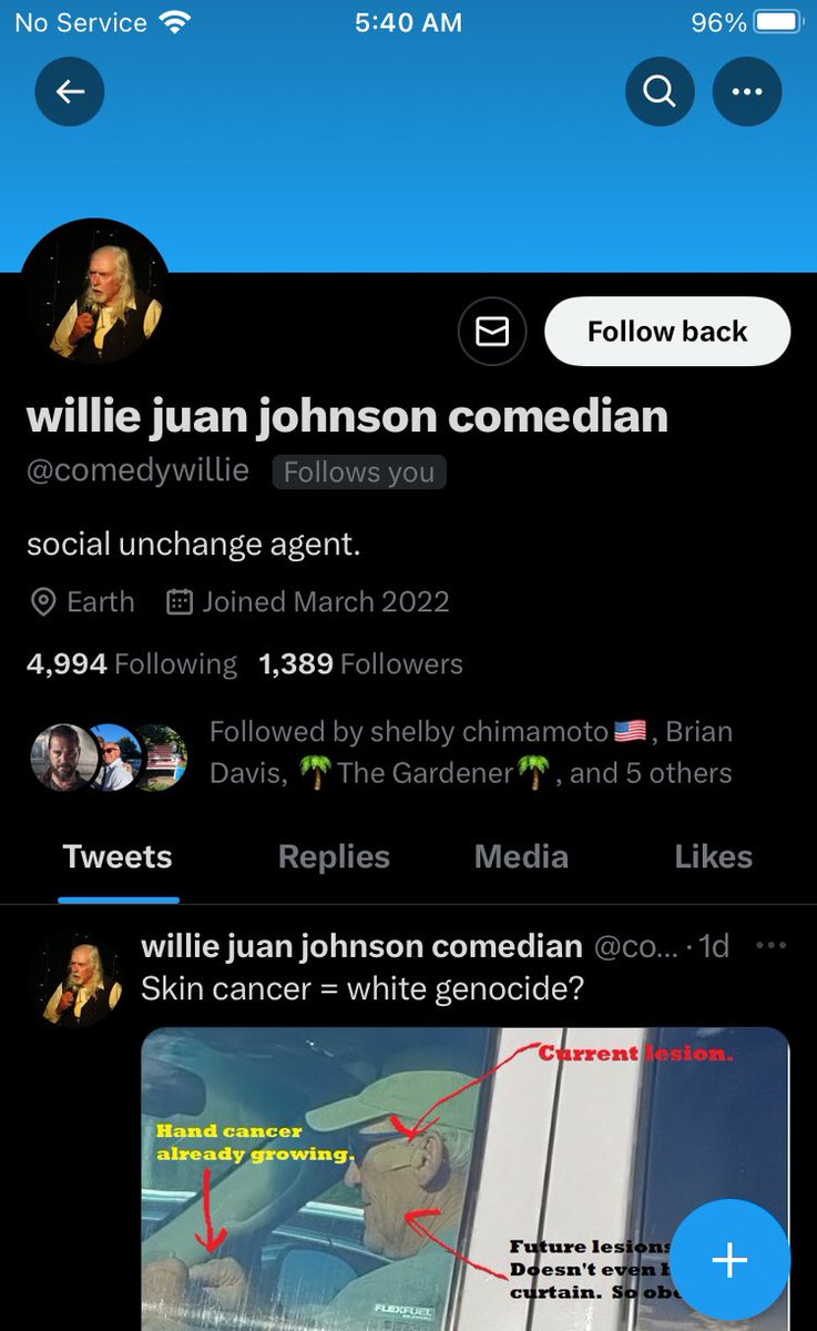 Shut up
white supremacist 
Anyone can get skin Cancer 
Not everyone is under the Crimebill

Why you still follow me I asked you to run away like the WS you are 
Try to devalue me and my words 
Misogynist Racist Bigot 
I said unfollow 
But you can’t proving my point 
Nothing funny
