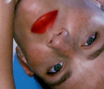 visagedelayla's tweet image. While lasers can work wonders for some skin types, it’s not the ideal treatment for everyone. Specifically, individuals with #Fitzpatrick Types III to VI are prone to postinflammatory hyperpigmentation. This is where #microneedling can provide patients a muchneeded alternative.