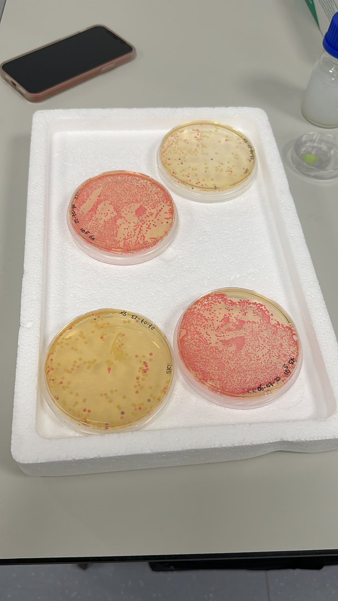 mgpisfil's tweet photo. Practical sessions start! Imaging some fluorescent colonies. 
@EMBLHeidelberg 
@EMBLEvents 
#EMBLFluorescenceLifetime https://t.co/wTocXOCBcV