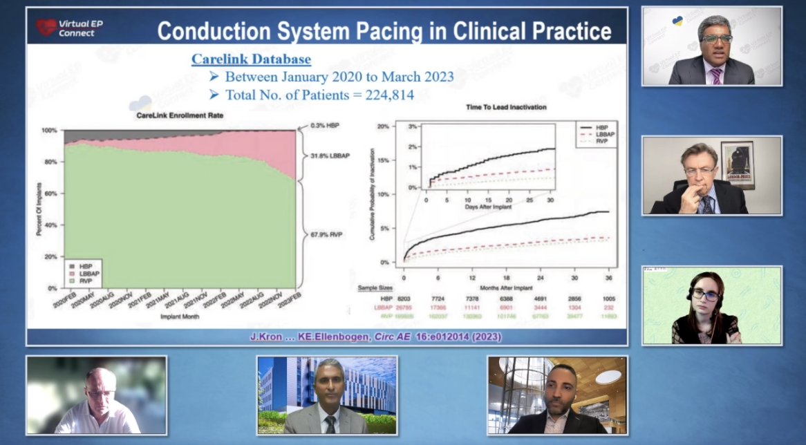 #epeeps. Now Available in @connectEP On-Demand Library. Session LIII: Outcomes of Left Bundle Branch Area Pacing w/ Pugazhendhi Vijayaraman, Vivek Reddy, Marek Jastrzębski, Margarida Pujol-Lopez, Frank Marchlinski and Parik Sharma. access @ epconnect.live/cspondemand