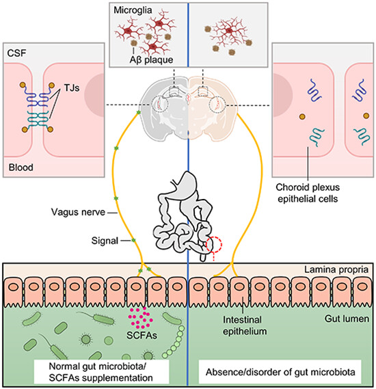 Gut microbiota regulates blood-cerebrospinal fluid barrier function and Aβ pathology
Roos Vandenbroucke <a href="/vdb_roos/">Roos Vandenbroucke</a> and colleagues <a href="/vdb_lab/">Vandenbroucke lab</a> <a href="/VIBLifeSciences/">VIB</a>
embopress.org/doi/full/10.15…