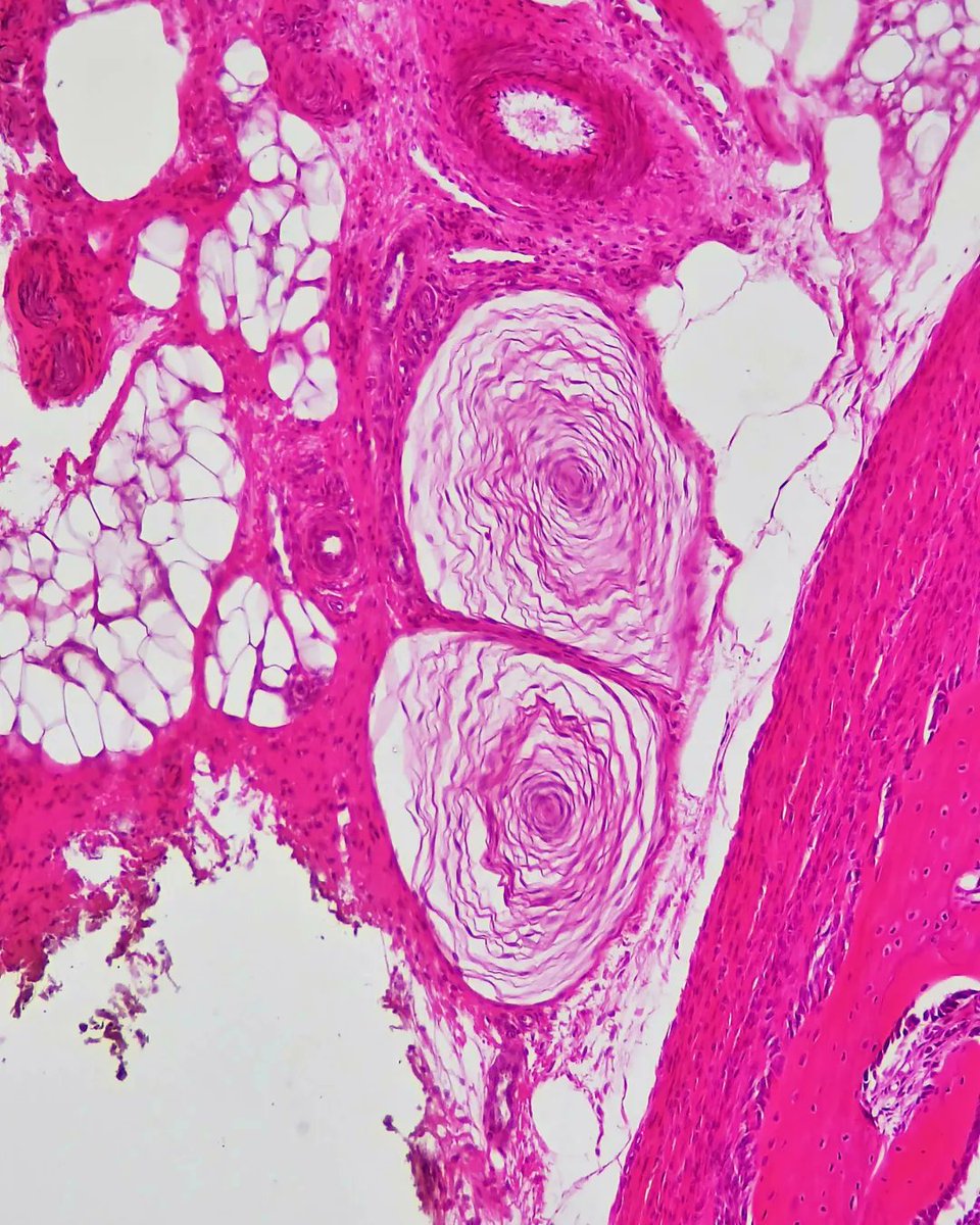 olkazuraw's tweet photo. Discovering Pacinian corpuscles' cute histology pattern in a finger cross-section today. 

Essential for vibration sensation and super T-shirt worthy! 🖐️ 

#PathArt #DigitalArt #ILoveHistology #MicroscopicPhotography https://t.co/pjFKdaqJtk