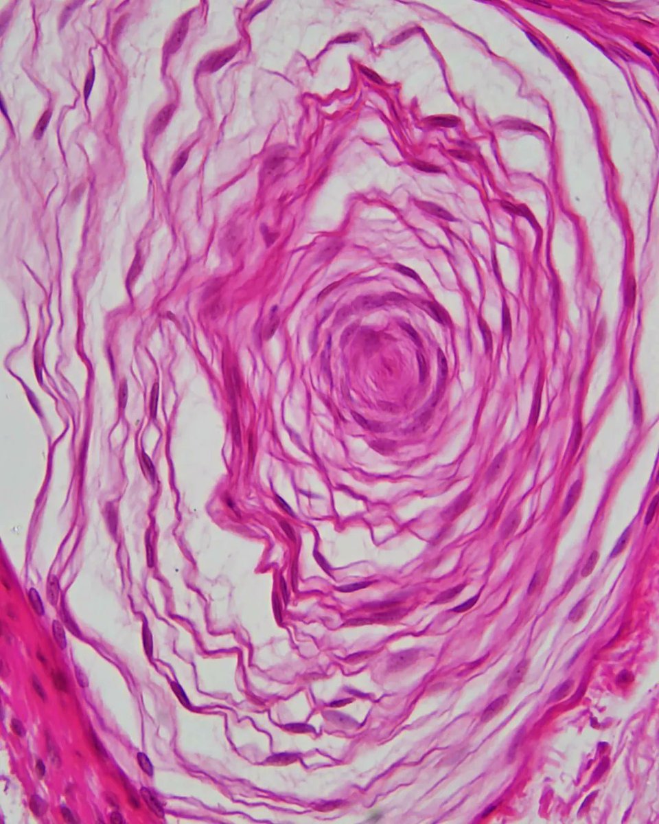 olkazuraw's tweet photo. Discovering Pacinian corpuscles' cute histology pattern in a finger cross-section today. 

Essential for vibration sensation and super T-shirt worthy! 🖐️ 

#PathArt #DigitalArt #ILoveHistology #MicroscopicPhotography https://t.co/pjFKdaqJtk
