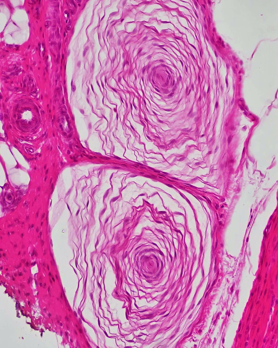 olkazuraw's tweet photo. Discovering Pacinian corpuscles' cute histology pattern in a finger cross-section today. 

Essential for vibration sensation and super T-shirt worthy! 🖐️ 

#PathArt #DigitalArt #ILoveHistology #MicroscopicPhotography https://t.co/pjFKdaqJtk