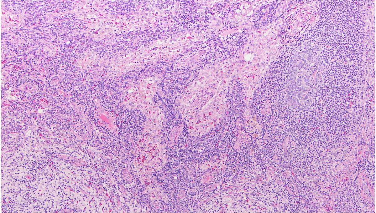 EmoryPathology tweet picture