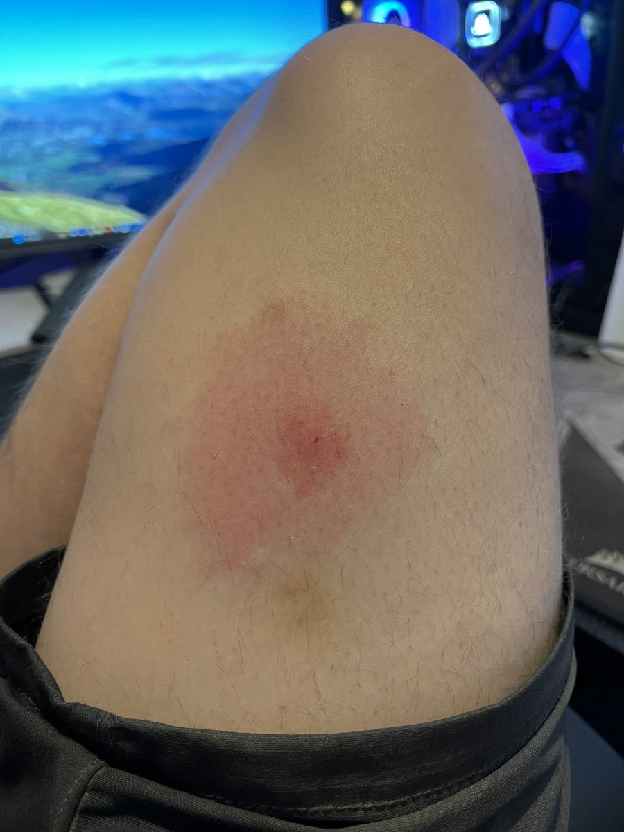 CaptainnCrash's tweet photo. Note to self! Practice what you preach and always have a check after a hike! https://t.co/iEiHbt8uFF