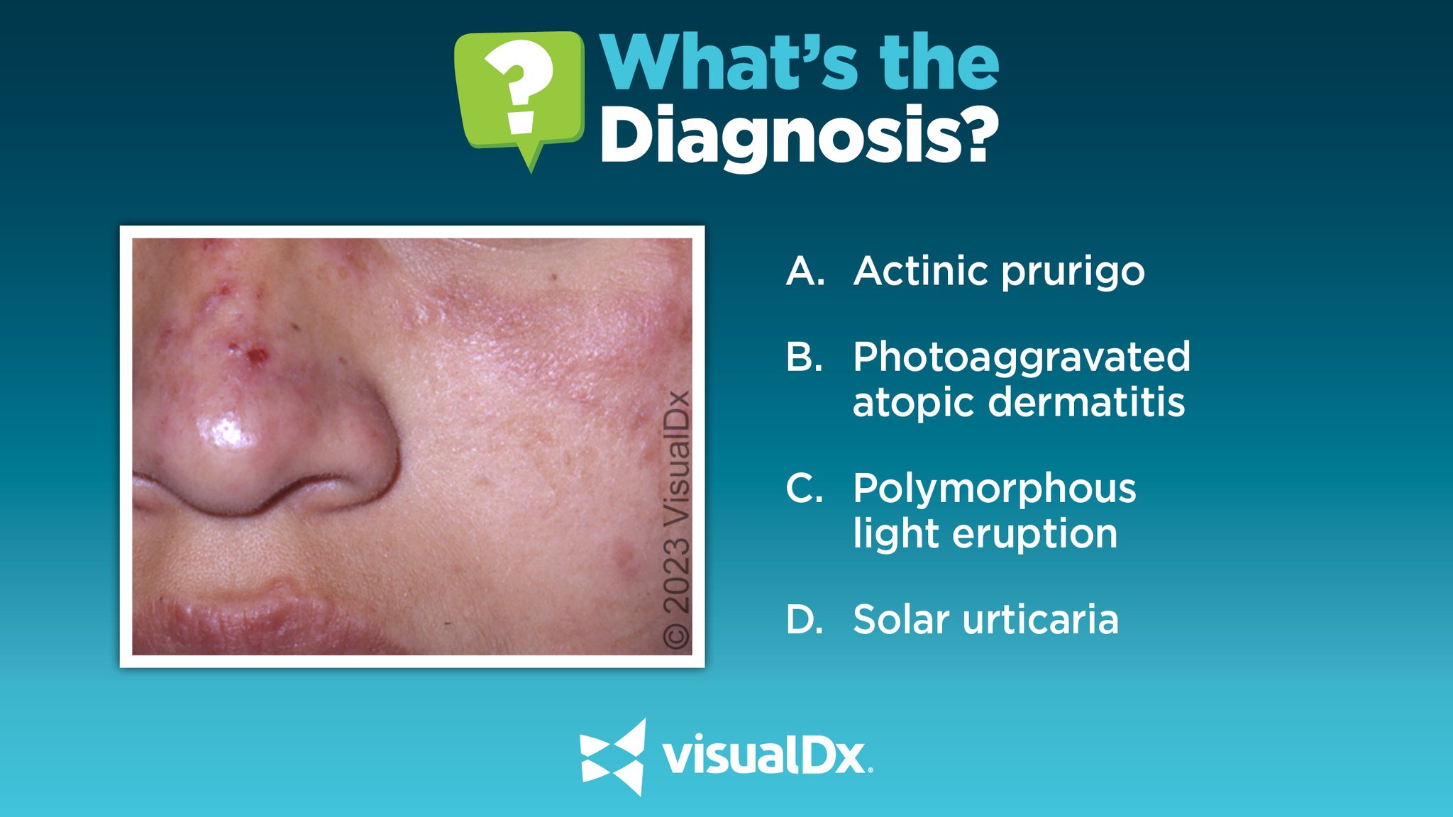 VisualDx on Twitter "What’s the Dx? A 13 yo Mexican girl w/ an itchy