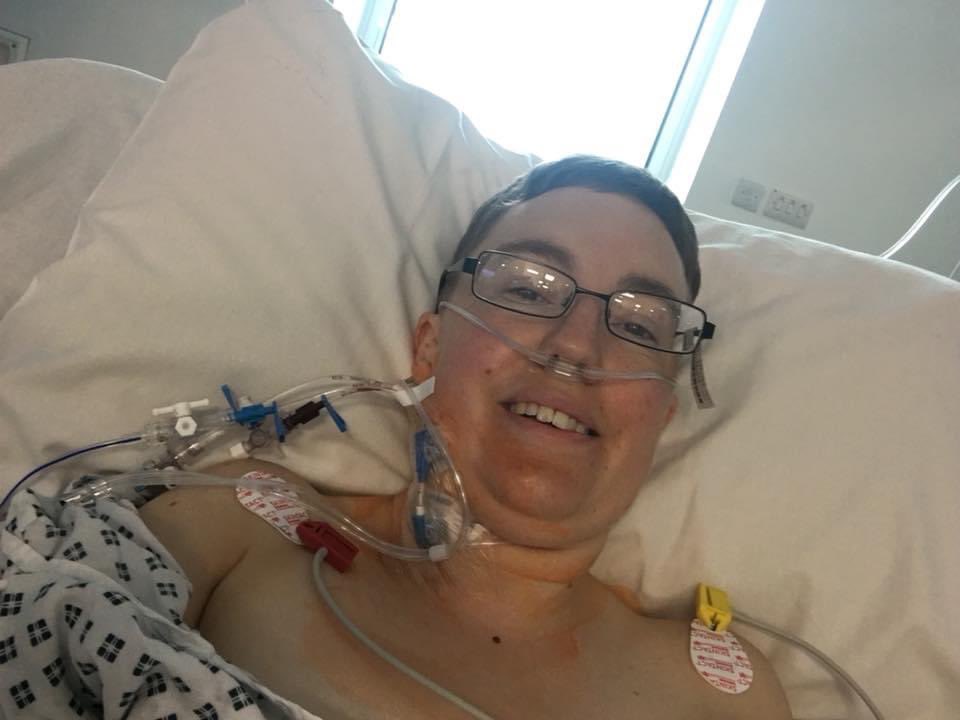 emilyjmacaulay's tweet photo. Five years ago today I had a liver resection. That was all #NHS75 and I celebrate every one of them this #NHS75birthday weekend.
(My liver is fully grown back and doing grand things, and my scar is looking fab #ChicksDigScars). https://t.co/oyF8LWrEFc