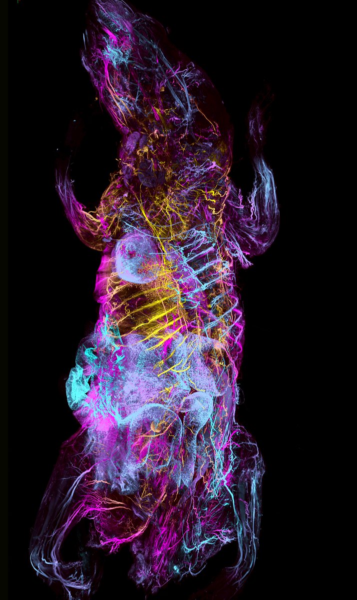 Ali Max Erturk (@erturklab) on Twitter photo Our new study is now published at <a href="/NatureBiotech/">Nature Biotechnology</a> as open access. What is in it? Online Whole-Body Mouse Atlases, tertiary lymphatic structures (TLS) in the whole mouse along cancer, and more. Meet wildDISCO, thread 👇🏼
nature.com/articles/s4158… Our new study is now published at <a href="/NatureBiotech/">Nature Biotechnology</a> as open access. What is in it? Online Whole-Body Mouse Atlases, tertiary lymphatic structures (TLS) in the whole mouse along cancer, and more. Meet wildDISCO, thread 👇🏼
nature.com/articles/s4158…