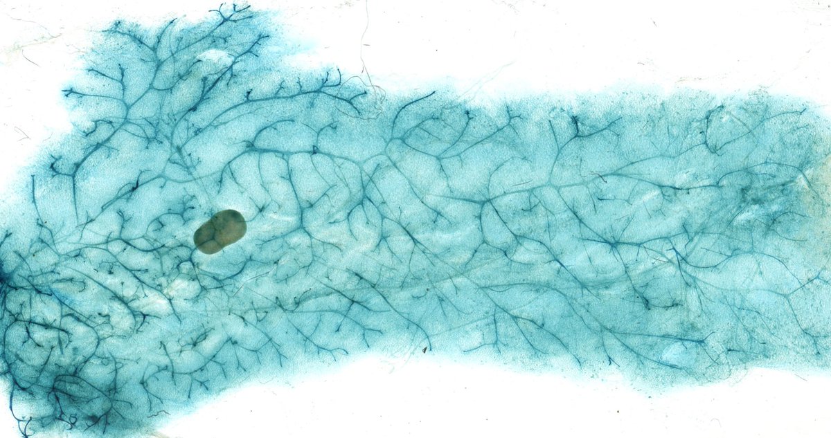 PKennyLab's tweet photo. GRB7 is co-amplified with HER2 in #BreastCancer &amp; acts as an adapter in multiple RTK pathways.

PREPRINT: Grb7 KO mice are viable &amp; fertile but females fail to raise pups to weaning, suggesting a role for Grb7 in regulation of #lactation physiology.
 
https://t.co/5y2tV4Mezd https://t.co/YAJdW3aa4L
