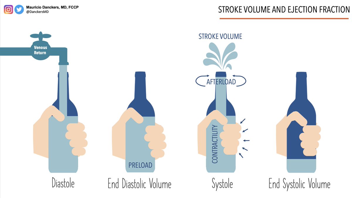 A great Monday with our Hemodynamic Monitoring Mini Symposium Day 0️⃣1️⃣ Can't wait for tomorrow 🤓

#CHESTTrainees <a href="/accpchest/">CHEST</a> @acpflchapter @acpimphysicians @sccm <a href="/atscommunity/">American Thoracic Society (ATS)</a> <a href="/atsearlycareer/">ATS Early Career</a>  <a href="/umiamimedicine/">Miller Medicine</a> @fiuinternalmed @fiuinstagram <a href="/NSUFlorida/">Nova Southeastern U.</a> <a href="/FIU/">FIU</a>