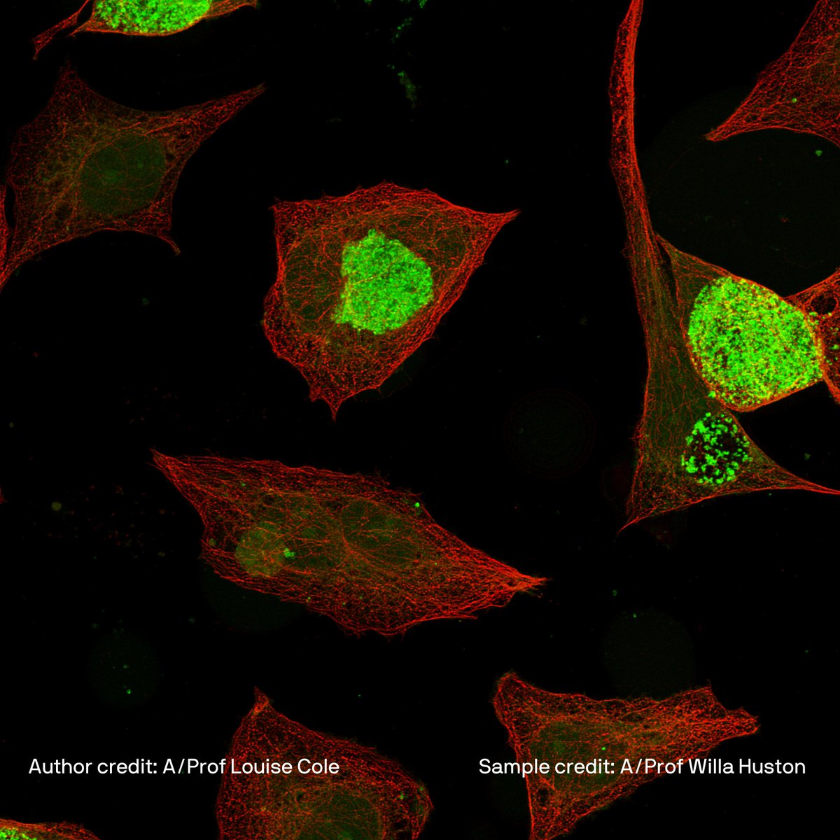 These two images show cultured cells infected with Chlamydia and labelled for the actin cytoskeleton. Taken using the Leica Stellaris SP8 confocal microscope in the Microbial Imaging Facility (MIF) at UTS. #microscopy #microbial #microscope @AIMI_UTS