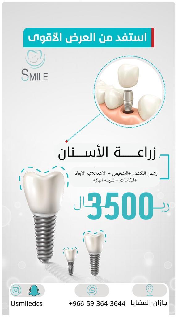 usmiledcs's tweet photo. #زراعة_الاسنان  #الاسنان #عيادة_الاسنان https://t.co/GcP6rIImWU