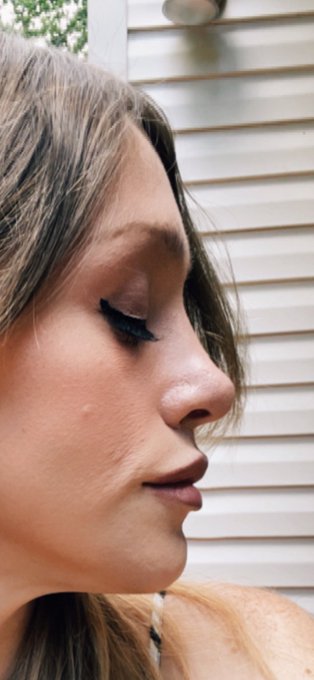 Calling it plastic surgery discredits all that it can really do for a person. I know what&rsquo;s more important