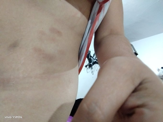 Paralisis del sue&ntilde;o al fin supe que no era , cuando en mi pesadilla un hombre estaba abusando de mi y<a href="/tag/tiktok"class="tags"><span>#tiktok</span></a><a href="/tag/barbiethemovie"class="tags"><span>#barbiethemovie</span></a><a href="/tag/cinecolombia"class="tags"><span>#cinecolombia</span></a><a href="/tag/centromayor"class="tags"><span>#centromayor</span></a>
