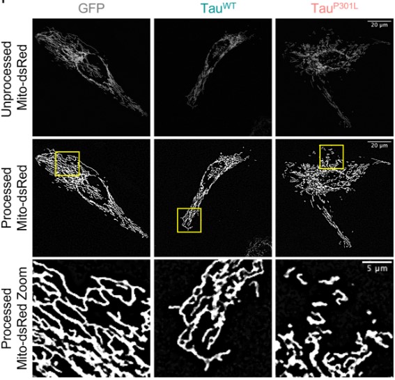 J Cell Science (@j_cell_sci) on Twitter photo In their #OpenAccess Research Article, <a href="/hopeneeds/">Hope Isobel Needs</a>, Kevin Wilkinson, Jeremy Henley & <a href="/IanofBristol/">Ian Collinson</a> <a href="/LabCollinson/">Collinson Lab</a> <a href="/BristolBiochem/">Bristol Biochemistry</a> find that aggregation-prone Tau impairs mitochondrial import, affecting mitochondrial morphology & inducing neurodegeneration.
journals.biologists.com/jcs/article/13… In their #OpenAccess Research Article, <a href="/hopeneeds/">Hope Isobel Needs</a>, Kevin Wilkinson, Jeremy Henley & <a href="/IanofBristol/">Ian Collinson</a> <a href="/LabCollinson/">Collinson Lab</a> <a href="/BristolBiochem/">Bristol Biochemistry</a> find that aggregation-prone Tau impairs mitochondrial import, affecting mitochondrial morphology & inducing neurodegeneration.
journals.biologists.com/jcs/article/13…