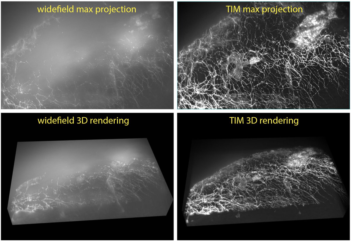 Want to achieve high-speed confocal quality neurite images using your inexpensive widefield microscope? Check out our TIM research in bioRxiv! The image displays a comparison between our TIM and widefield imaging on live zebrafish.
biorxiv.org/content/10.110…