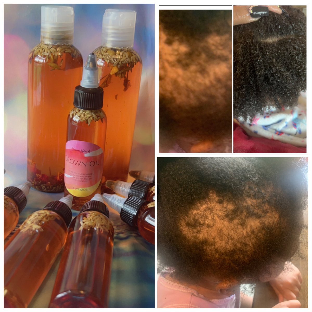 NaturalTasami's tweet photo. Tasami Natural Crown Oil is made with super rich and nourishing oils that are perfect for hair.
Made with Argan  oil, avocado oil, tea tree oil, and a host of other scalp nourishing all natural and organic oils.
Helps with itching and promotes growth.

https://t.co/iQJg0CU4xo https://t.co/mup7qCQmxx