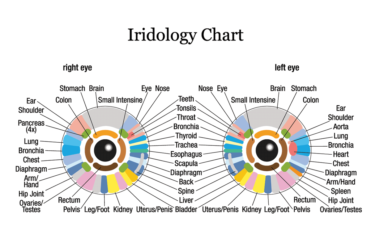 AlpacaAurelius's tweet photo. has anybody else noticed that their eyes have changed colors as theyve gotten healthier? mine have gotten noticeably bluer over time.

your eyes peak volumes about your health. a field called iridology can actually diagnose problems with specific tissues like the gut, liver and lymphatic system based on discolorations in the iris of your eye.

other suggest that heavy metals and inflammation cause a darkening of the eye and detox reverts your eyes to their more natural state.

ive also noticed that when im in a higher dopamine, better mood state, my eyes tend to be much brighter blue.

very fascinating field.