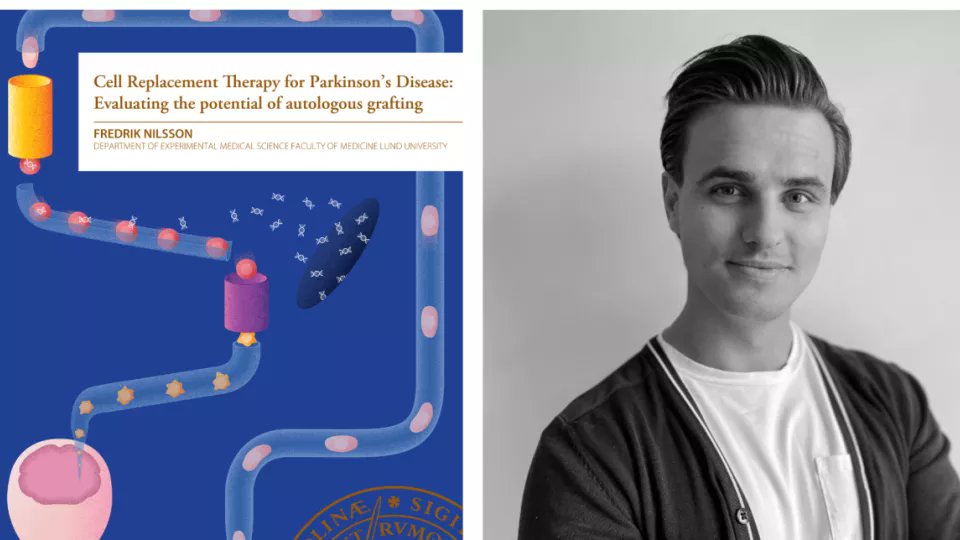 MultiparkL's tweet photo. In May, Fredrik Nilsson in @ParmarLab successfully defended his thesis about patient-specific cells in #cellreplacement therapy for #PD. Read about is findings and their potential therapeutic implications. #neuroscience #PhD @Lund_Stem @medfak_LU
https://t.co/eFpXsSOUb4 https://t.co/w4V2YvTw3c
