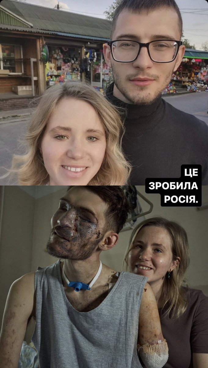 IrynaVoichuk's tweet image. For those who want to support Andrii and his wife

Photo by @Liberov 
send.monobank.ua/jar/7kniCnvh1?…