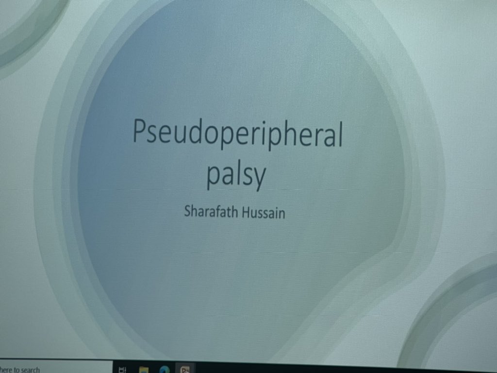 Thank you Sharafath for an interesting Tuesday teaching session for the MDT today #tuesdayteaching @uhl_stroke