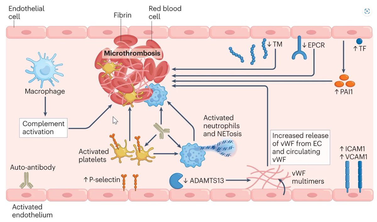 Nature Rev Immunol (@natrevimmunol) on Twitter photo New: Our current understanding of the immunology behind #LongCovid, a comprehensive Review by @Daltmann10, Emily M. Whetlock, Siyi Liu, Deepa J. Arachchillage and <a href="/BoytonRosemary/">RosemaryBoyton</a>
nature.com/articles/s4157… New: Our current understanding of the immunology behind #LongCovid, a comprehensive Review by @Daltmann10, Emily M. Whetlock, Siyi Liu, Deepa J. Arachchillage and <a href="/BoytonRosemary/">RosemaryBoyton</a>
nature.com/articles/s4157…